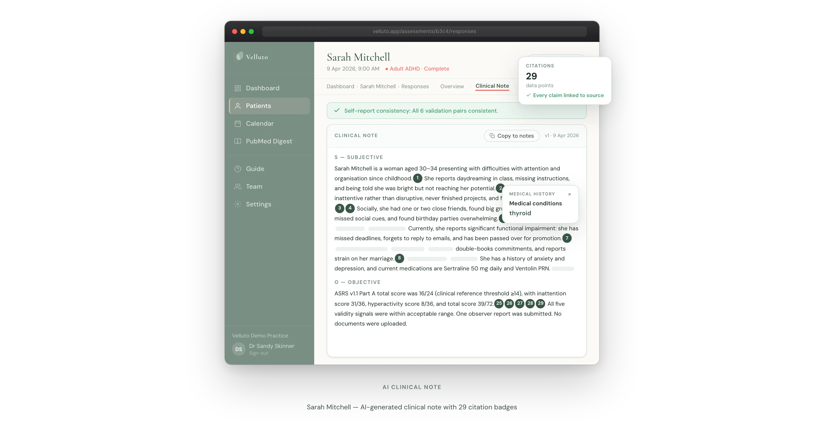 AI-generated clinical summary in Velluto, structured for GP review with no diagnostic conclusion